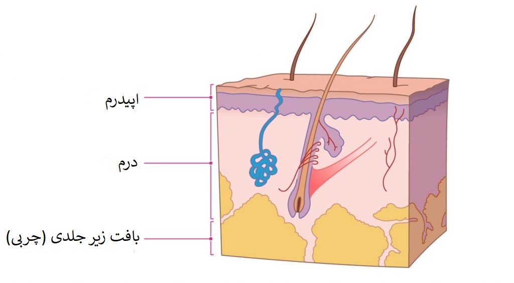 سرطان ملانوما